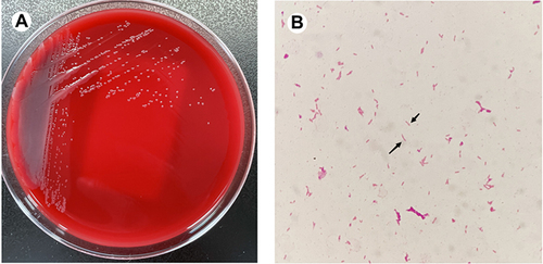 Figure 1 Colony characteristics and gram staining of R. mannitolilytica. (A) R. mannitolilytica grew on Columbia blood agar for 24 hours. Colonies are round, small, 1–2mm, grey, moist. (B) Gram staining suggested gram-negative bacilli in the blood culture bottle (10×100). R. mannitolilytica is indicated by arrows.