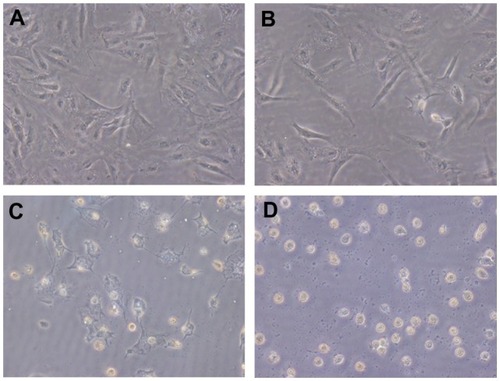 Figure 7 Detection of apoptotic tumor cells by TUNEL assay in the four groups. The magnification of the light microscope was 200×. (A) control, (B) EAK, (C) ellipticine, and (D) EAK-EPT.Abbreviations: EAK, self-assembling EAK16-II peptide; EPT, ellipticine; TUNEL, terminal deoxynucleotidyl transferase.