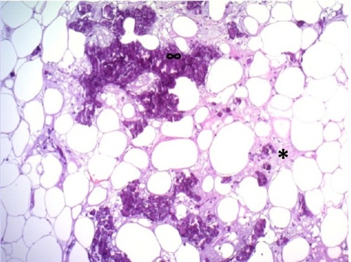 Figure 2 Hematoxylin and eosin stain, magnification 100×.