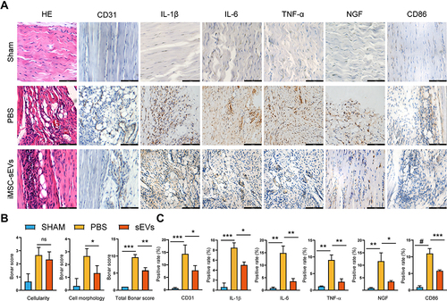 Figure 3 iMSC-sEVs alleviate inflammatory cytokine infiltration in rat tendinopathy model. (A) Representative photomicrographs of H&E and immunohistochemically stained tissue sections of different groups at week 5 after model establishment. Positive immunostaining of IL-1β, IL-6, TNF-α, and NGF was visualized with DAB (brown), and nuclei were counterstained with hematoxylin (blue). Scale bar = 100μm. (B) Modified Bonar score, including cell morphology and cellularity, is used for semiquantitative histology analysis. C Quantitative analysis of immunohistochemical staining. Data are expressed as mean ± SD. *P < 0.05. **P < 0.01. ***P < 0.001. #P < 0.0001.