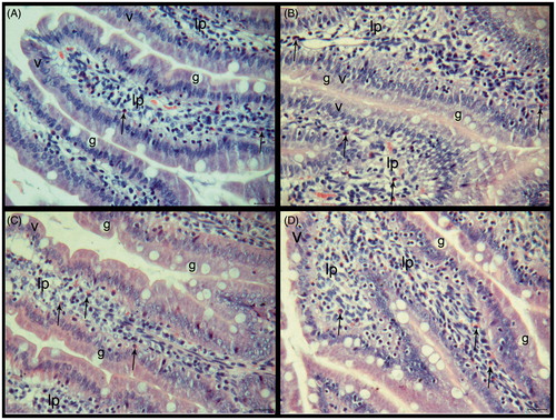 Figure 3. (A–D) Histological sections of the small intestine tissue of the experimental groups. (A) Control, (B) HED group, (C) HED + PLE group, and (D) PLE group. Villus (V), lamina proprea (lp), Goblet cells (g) and leukocytes (→). HE, scale bar: 20 μm.