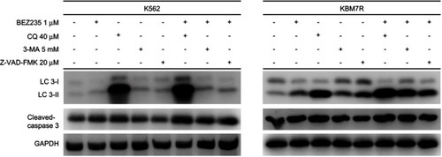 Figure 11 Effect of BEZ235 combined with autophagy and apoptosis inhibitor on the expression of autophagy and apoptosis-related proteins.