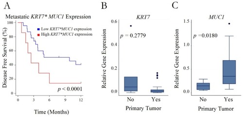 Figure 3 Recurrence after initial metastasectomy. (A) Disease-free survival after initial metastasectomy in patients with a high versus low interaction term for KRT7 and MUC1 expression in their resected metastatic sarcoma lesions. (B and C) Boxplots of relative gene expression of either KRT7 or MUC1 in the primary tumors of patients who either did (Yes) or did not (No) experience recurrence of their pulmonary metastasis after metastasectomy.