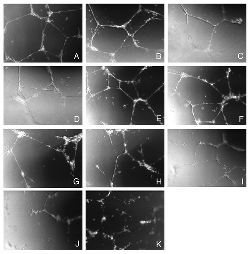 Figure 5. Effects of ZOL on HUVEC tubule formation. Representative photomicrographs of HUVECs plated on Matrigel after 24 h of treatment: with (A) vehicle control; (B) 0.31 μM ZOL; (C) 0.62 μM ZOL; (D) 1.25 μM ZOL; (E) 2.5 μM ZOL; (F) 5 μM ZOL; (G) 10 μM ZOL; (H) 20 μM ZOL; (I) 40 μM ZOL; (J) 80 μM ZOL; (K) 160 μM ZOL. Pictures were taken at magnification 10 × .