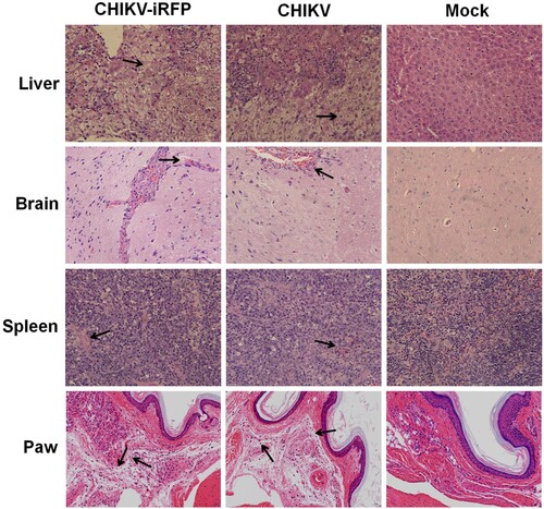 Figure 6. Histology of tissue sections from mice infected with CHIKV and CHIKV-iRFP. The tissues (liver, brain, spleen and paw) from the mice infected with CHIKV-iRFP, WT CHIKV or PBS were collected at 5 dpi and then stained via the haematoxylin and eosin method (H&E) 400X. The arrows indicated the typical histological lesions in the detected tissues.
