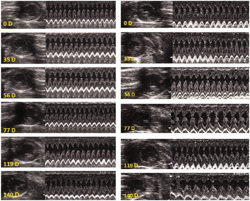 Figure 8. Echocardiography of one rat treated with HPMA copolymer (left) and another rat treated with HPMA copolymer–DOX conjugate (right). B mode is shown at left and M mode at right. Note an increase in left ventricular internal diameter in systole and diastole on day 140 (140D) in HPMA copolymer–DOX-treated rat (right bottom).