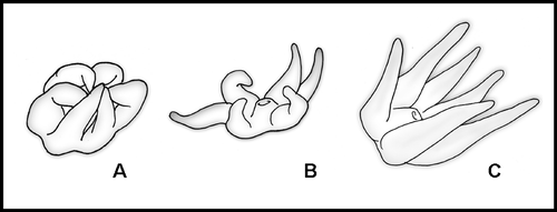 Figure 2 Comparison of the contracted polyps of the three unbranched genera. A, Cirrhipathes; B, Stichopathes; C, Pseudocirrhipathes.