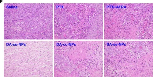 Figure 4 In vivo antitumor effect of all drug formations.Notes: (A) Tumor volumes of different groups of tumor-bearing mice at different days after treating with physiological saline, free PTX, PTX+ATRA, DA-ss-NPs, DA-cc-NPs, SA-ss-NPs and P-ss-NPs (***significant difference between DA-ss-NPs and DA-cc-NPs or SA-ss-NPs). (B) Excised tumor weight of different groups. (C) Mice weight of different treatment groups. (D) Photos of excised tumors. (E) Histology analysis by H&E staining was performed for the different treatment groups using a virtual microscope (200× vision). All data were represented as mean±SD. n=6, *P<0.05, **P<0.01 and ***P<0.001.Abbreviations: PTX, paclitaxel; ATRA, all-trans-retinoic acid.