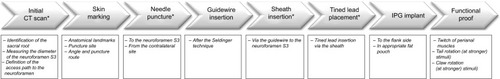 Figure 5 Stepwise description of the tined lead implantation technique from the initial CT scan to the final intraoperative functional proof.