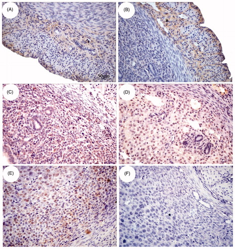 Figure 5. Immunohistochemical localization of β2-AR in the uterus of pregnant mice. The position of β2-AR in the uterus changes with the age of pregnancy. The expression of β2-AR-positive cells in the myometrium (A), vascular layer (B) and part of endometrium (C) on E3. Moreover, at E5 (D) and E7 (E), β2-AR expression was found in glandular epithelial cells, luminal epithelial cells and endometrium stromal cells. F shows β2-AR-negative cells. Bar = 50 μm.