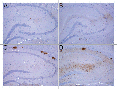 Figure 2. Abnormal PrP deposition in hippocampus of RIII and VM mice following inoculation with BSE or vCJD. (A) BSE in RIII mouse; (B) vCJD in RIII mouse; (C) BSE in VM mouse; (D) vCJD in VM mouse (bar, 100 μm; anti-PrP antibody: 6H4).