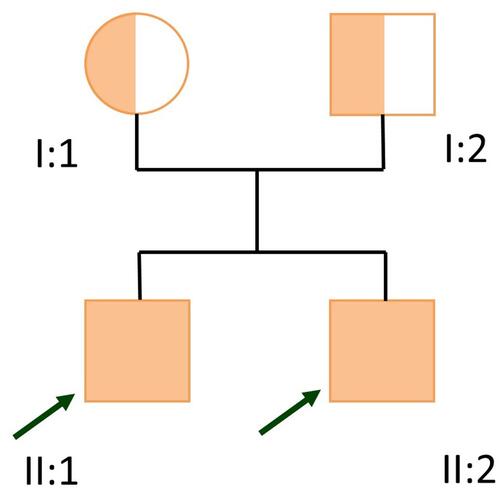 Figure 2 Familial pedigree.