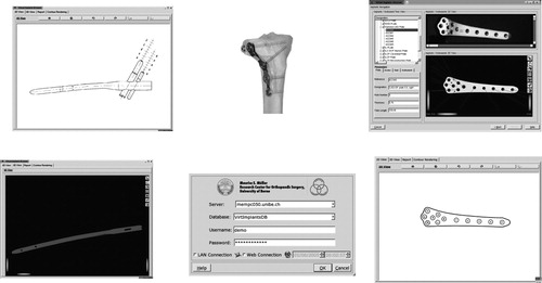 Figure 9. Virtual implant browser. (color version available online)