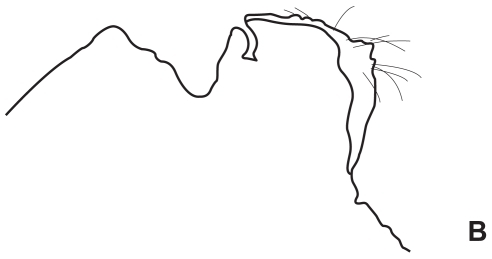 Figure 3B Line diagram of Figure 3A.