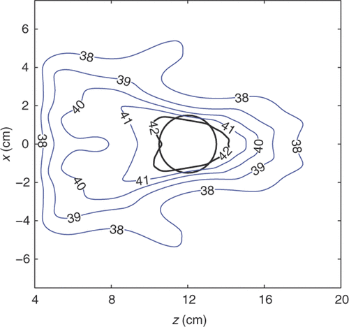 Figure 6. Simulated temperature (°C) in the y = 0 plane calculated from the power deposition obtained with waveform diversity and mode scanning using the 13 optimal tumour control points in quadrant I. This result corresponds to the largest value of the tumour volume heated above 42°C in Figure 4.