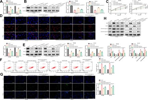 Figure 7 Regulation of ZNF277 by Duxap8 is mediated by miR-519b-3p. (A) RT-qPCR analysis of the expression level of ZNF277 in SW480 and HT-29 colorectal cancer cells. (B) Western blot analysis of the expression level of ZNF277 in SW480 and HT-29 colorectal cancer cells. (C) CCK-8 assay. (D) EdU assay. (E) Protein expression levels of key regulators involved in cell proliferation. (F) Flow cytometry analysis. (G) TUNEL assay. (H) Western blot analysis of expression levels of BAX, BCL-2, cleaved-Caspase 3, and cleaved-Caspase 9. **P < 0.01 vs Sh-NC group. #p < 0.05, ##P < 0.001 vs Sh-Duxap8 group. ΔP < 0.05 vs Sh-Duxap8 + Inhibitors NC group. All results were presented as the mean ± SD from at least three separate experiments.