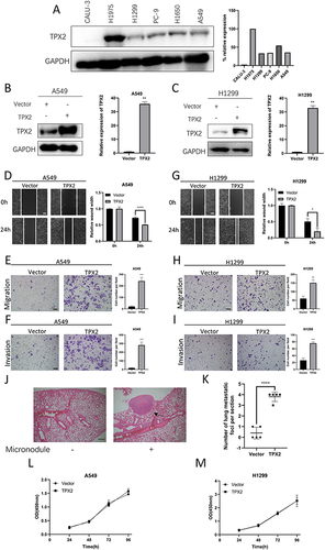 Figure 2 TPX2 overexpression promoted the migration and invasion abilities of NSCLC cells. (A) Western blotting analysis of TPX2 expression in six NSCLC cell lines. (B and C) The overexpression efficiency of TPX2 in A549 (B) and H1299 (C) was identified at the protein and RNA levels using Western blotting (left) and RT‒qPCR (right). (D–F) Effects of TPX2 overexpression on wound healing (D), transwell migration (E) and invasion (F) Abilities of A549 cells. Scale bar: 100 µm. (G–I) Effects of TPX2 overexpression on wound healing (G), transwell migration (H) and invasion (I) abilities of H1299 cells. Scale bar: 100 µm. (J) H&E staining showing representative photos of positive and negative metastatic nodules in the lung. Scale bar: 200 µm. (K) The scatterplot shows the number of lung metastatic foci per mouse. (L and M) Growth curve of A549 (L) and H1299 (M) cell lines (Vector represents negative control of overexpression, TPX2 represents overexpression of the TXP2 gene). Each bar displays the mean±SD of 3 independent experiments as analyzed by paired two-tailed students, t-test. *p<0.05, **p<0.01, ***p<0.001 and ****p<0.0001.