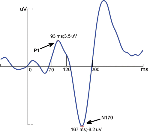 Figure 2. The diagrammatic drawing of peak amplitudes and latencies for P1 and N170, which were automatically measured between 70 ms and 120 ms and between 120 ms and 200 ms, respectively.