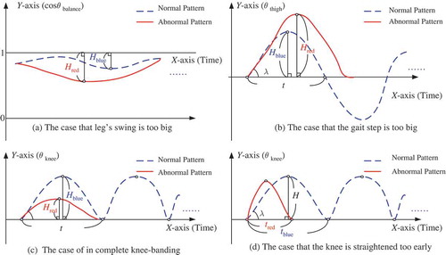 FIGURE 9 Examples for abnormal gait pattern classification.