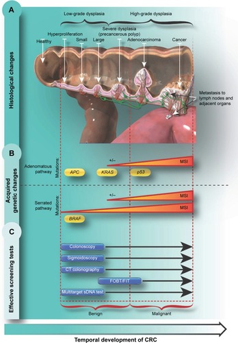 Figure 1 CRC development and screening methods.