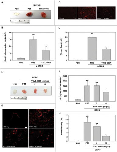 Figure 1. TTAC-0001 exhibits anti-angiogenic activity in U-87MG and MCF-7 Matrigel plug assays. Neovascularization in Matrigel plugs was quantified by evaluating hemoglobin (Hb) content after injecting female BALB/c-nu mice with 0.5 mL Matrigel mixed with 1 × 106 U-87MG cells and 5 × 106 MCF-7 cells into the bilateral flanks. Mice were treated with intravenous injection of 10 mg/kg TTAC-0001. Matrigel plugs with U-87MG cells were removed at day 10. (A) Gross overview of Matrigel plug and (B) hemoglobin (Hb) content (mean ± SE, n = 8). (C) Immunohistochemical images showing CD31-positive blood vessels (red) in the Matrigel plug. Scale bars = 200 µm. (D) Density of CD31-positive blood vessels in the Matrigel plug. (mean ± SE, n = 8). ### p < 0.001 vs. phosphate buffered saline (PBS) only, *** p < 0.001 vs. U87MG + PBS. Matrigel plugs with MCF-7 cells were removed at day 10. (E) Gross overview of Matrigel plug and (F) Hb content (mean ± SE, n = 8). (G) Images showing CD31-positive blood vessels (red) in the Matrigel plug. Scale bars = 200 µm. (H) Densities of CD31-positive blood vessels in the Matrigel plug (mean ± SE, n = 8). * p < 0.05, *** p < 0.001 vs. MCF-7 + PBS.