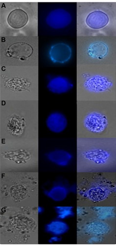 Figure 5 Representative fluorescence microscopic images of captured Entamoeba invadens cyst.Notes: The figures show the fluorescence microscopic images of Entamoeba spp. cyst sample untreated with CSO-INPs (A), treated with 0.5 mg/mL CSO-INPs (B), treated with 1 mg/mL CSO-INPs (C), treated with 2 mg/mL CSO-INPs (D), treated with 3 mg/mL CSO-INPs (E), treated with 4 mg/mL CSO-INPs (F), and treated with 5 mg/mL CSO-INPs (G).Abbreviation: CSO-INPs, chitosan oligosaccharide-functionalized iron oxide nanoparticles.