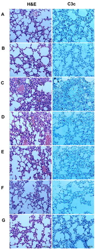 Figure 7. DYY-4 ameliorated the pulmonary injury in ALI mice. Lungs from each group were processed for histological evaluation at 24 h after LPS challenge: Section of control (A) and DYY-4 (B) groups mice: normal lung tissue sections (H&E and complement). Section of the LPS-induced ALI model (C) group mice: note increased alveolar wall thickness, inflammatory cells aggregation (arrows and five-pointed star), pulmonary haemorrhage (H&E), and the patchy dense immunoperoxidase indicative of depositions of complements (complement). Section from 15, 30, and 60 mg/kg DYY-4 treated (D, E, F, respectively) and DXM-treated (G) groups mice: note mild alveolar wall thickness, reduced inflammatory cells aggregation, little pulmonary haemorrhage (H&E) and little complement deposition (complement), (400 ×).