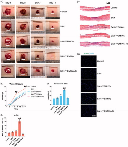 Figure 4. H19EMNVs promoted healing of diabetic wounds. (a) Representative images of full-thickness skin defects in a diabetic rat model, left untreated (control) or treated with SAH, SAH-293EMNVs, SAH-H19EMNVs or SAH-H19EMNVs together with RI (BMS-754807), at 0, 3, 7 and 14 days after operation. Scale bar: 10 mm. (b) Percentage wound closure of untreated defects and defects treated with SAH, SAH-293EMNVs, SAH-H19EMNVs or SAH-H19EMNVs together with RI (BMS-754807) at 3, 7 and 14 days after surgery. *p < .05 compared with control. #p < .05 compared between SAH-H19EMNVs and SAH-293EMNVs. (c) Transmitted light images of HE-stained sections of the untreated defects (control) and the defects treated with SAH, SAH-293EMNVs, SAH-H19EMNVs or SAH-H19EMNVs together with RI (BMS-754807) at 14 days after operation (scale bar = 2 mm). The total width of the image represents the initial defect size (1.8 cm) while the white arrows indicate the length of full thickness wound healing. (d) Total length of full thickness wound healing (renascent skin) in the skin defects left untreated (control), treated with SAH, SAH-293EMNVs, SAH-H19EMNVs or SAH-H19EMNVs together with RI (BMS-754807) at 14 days after operation. *p < .05 compared with control. #p < .05 compared between SAH-H19EMNVs and SAH-293EMNVs. (e) Immunofluorescence images of p-Akt counterstained with DAPI; scale bar, 100 μm. (f) Rate of positive cells (%) in (e). *p < .05 compared with control. #p < .05 compared between SAH-H19EMNVs and SAH-293EMNVs.