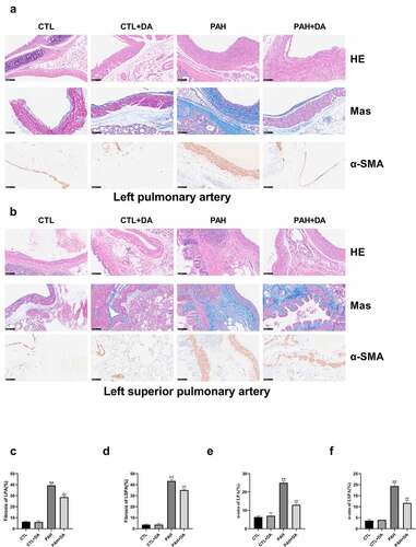 Figure 6. Effects of Dapagliflozin on the left pulmonary artery and the left superior pulmonary artery. Representative images of HE, Masson and α-SMA staining (a-b). Quantified results of Masson and α-SMA staining (c-f) (n = 3 per group). Data are presented as mean as ±SEM. *P < 0.05 vs. CTL group, #P < 0.05 vs. PAH group. **P < 0.01 vs. CTL group, ##P < 0.01 vs. PAH group. Abbreviations: HE, hematoxylin-eosin staining; Mas, Masson staining; α-SMA, alpha-smooth muscle actin; LPA, left pulmonary artery; LSPA, left superior pulmonary artery.