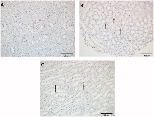 Figure 2. Immunohistochemical staining of the three groups. Apoptotic cells are not encountered in the Sham group (A). Ischemic tissue has dense apoptosis (B). Apoptotic cells are diminished in the antioxidant group (C).
