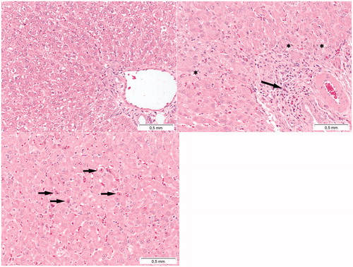 Figure 11. Presence of toxic effects in the liver following Cu2CO3(OH)2 NP administration. The top left image represents the liver of a vehicle control treated animal. The top right image indicates the presence of inflammation (arrow) and vacuolisation (asterisks) of liver parenchyma cells. The bottom image indicates single cell necrosis of liver cells (arrows). The autopsy was conducted at day 7, 2 days after the last Cu2CO3(OH)2 NP administration. The liver with histopathological lesions was from an animal treated with 128 mg/kg b.w. of Cu2CO3(OH)2 NPs for five consecutive days (days 1-5).