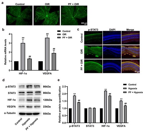 Figure 6. PF inhibits the angiogenesis in a rat model of OIR via downregulation of HIF-1α/VEGFA pathway. (a) The angiogenesis in retinal tissue was measured with FITC-dextran staining. (b) The gene expression of HIF-1α and VEGFA in retinal tissue was detected with RT-qPCR. (c) The expression of p-STAT3 in retinal tissue was measured with immunofluorescence staining. (d, e) The protein level of p-STAT3, HIF-1α, and VEGFA in retinal tissue was determined by western blot. **P < 0.01 compared with the control group; ##P < 0.01 compared with the hypoxia group; n = 3.