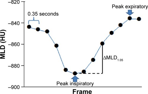 Figure 2 Example of the continuous mean lung density (MLD) measurement.
