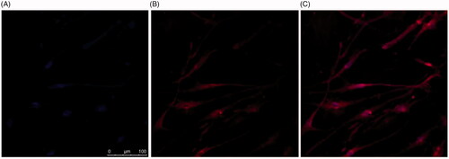 Figure 8. Localization of DilC labelled liposomes loaded with naringenin and 2% w/w Tween 20 suspended in HPMC gel in HDFa cells. Cells were grown on the coverslips for 2 d. Cell nuclei were visualized using (A) DAPI. Liposomes were formulated with DilC for visualization (B). Liposome localization within the cell is shown in the merged image (C).