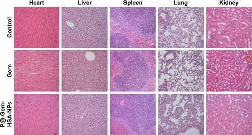 Figure 6 In vivo long-term toxicity of Gem and P@-Gem-HSA-NPs after intravenous injection (Gem equivalent: 100 mg/kg).Notes: H&E-stained images of major organs (heart, liver, spleen, lung, and kidney) collected from healthy C57BL/6 mice treated by NS (control group), Gem, and P@-Gem-HSA-NPs under NIR irritation. All healthy C57BL/6 mice were injected with various treatments and sacrificed at 10 days post-IV for tissue assays Bar: 100 μm; magnification ×200.Abbreviations: Gem, gemcitabine; H&E, hematoxylin and eosin; HSA, human serum albumin; IV, intravenous injection; NIR, near infrared; NPs, nanoparticles; NS, normal saline; P@, pheophorbide-a.
