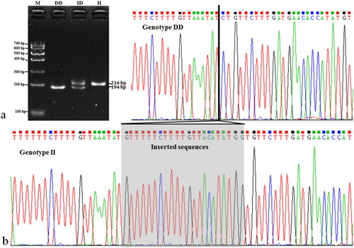 Figure 1. The electrophoresis Pattern (a) and sequence chromas (b) of ins31499 in the goat FGF7 gene. Note: a, M = molecular marker I; genotypes (II = 216 bp, DD = 194 bp, ID = 216 bp and 194 bp). b, the region with the gray box is the sequence of the 22-bp insertion.