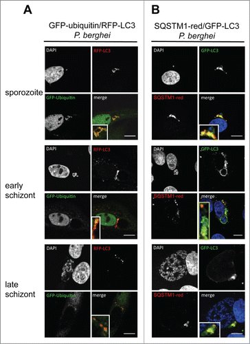 Figure 7. Colocalization of ubiquitin, SQSTM1, and LC3 in infected cells during parasite development. (A) GFP-Ubiquitin and RFP-LC3 double-transfected HepG2 cells were infected with wild-type P. berghei sporozoites and monitored by live microscopy at different developmental stages. The sporozoites are labeled by complete colocalization of ubiquitin and LC3, which is lost at later time points. DNA was stained with Hoechst 33342. (B) GFP-LC3 (green)-expressing HepG2 cells were infected, fixed at different developmental stages, and stained with an antibody specific for SQSTM1 (red). DNA was stained with DAPI (blue). Scale bars: 10 µm.