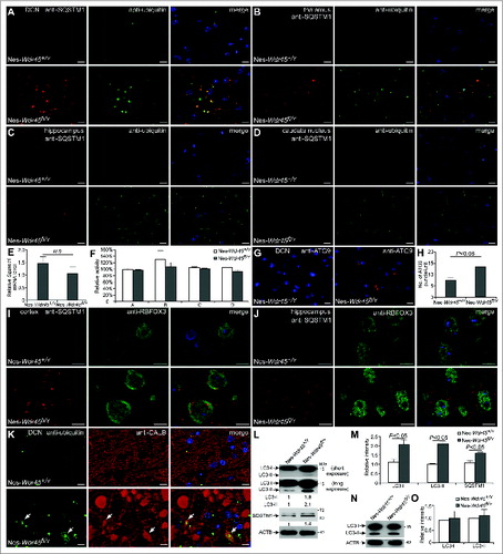 Figure 3. Nes-Wdr45fl/Y mice exhibit defective autophagic flux. (A–D) Coimmunostaining with anti-SQSTM1 (red) and anti-ubiquitin (green) antibodies in DCN (A), thalamus (B), hippocampus (C) and caudate nucleus (D) of Nes-Wdr45fl/Y mice at 13 mo. (E) No increase in the Sqstm1 mRNA level is detected in Nes-Wdr45fl/Y mice. (F) Compared to control littermates, proteasome activity is not altered in brain extracts of Nes-Wdr45fl/Y mice at 13 mo. Proteasome activity was measured using AMC-linked substrate peptides. A: Ac-Gly-Pro-Leu-Asp-AMC; B: Suc-Leu-Leu-Val-Tyr-AMC; C: Ac-Arg-Leu-Arg-AMC; D: Boc-Leu-Arg-Arg-AMC. Results are representative of 2 experiments. (G and H) Anti-ATG9 staining shows that ATG9 puncta accumulate in the DCN of Nes-Wdr45fl/Y mice at 13 months. Quantification data are shown as mean±SEM of 3 mice (1 unit = 104 μm2) (H). (I and J) Anti-RBFOX3 (green) and anti-SQSTM1 (red) costaining shows that SQSTM1 aggregates are located in pyramidal neurons in the cortex (I) and hippocampus (J) of Nes-Wdr45fl/Y mice at 13 mo. (K) Anti-ubiquitin (green) and anti-CALB (red) costaining in the DCN of Nes-Wdr45fl/Y mice at 13 mo (arrows indicate dilated axonal terminals). Bar: 10 µm (A–D, G, and I–K). (L and M) Immunoblotting assays show that levels of LC3-I, LC3-II and SQSTM1 are increased in Wdr45-deficient neurons. Data are relative to ACTB level and representative of 3 independent experiments. (N and O) Immunoblotting assays show that levels of LC3-I and LC3-II are comparable between WT and Wdr45-deficient neurons after 6 h treatment with 20 μM bafilomycin A1. Data are relative to ACTB level and representative of 3 independent experiments.