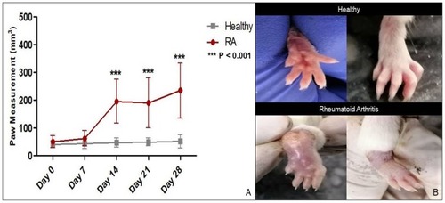 Figure 8 (A) Asterisks (***) indicate significant increase (P < 0.001) in paw volume at day 14, 21 and 28 during rheumatoid arthritis induction period. (B) Ventral and dorsal view of paw of a healthy mouse and a mouse with rheumatoid arthritis.Abbreviation: RA, rheumatoid arthritis.