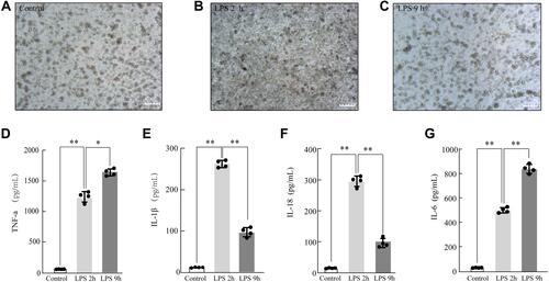 Figure 2 Modeling and validation of LPS-treated acute lung injury (ALI). The morphological changes of LPS-treated rat NR8383 alveolar macrophage (AM)(200×) Control (A), LPS 2 h (B), LPS 9 h (C); LPS-induced AM modeling for ALI was validated by measuring the inflammatory cytokine expression levels of TNF-α (D), IL-1β (E), IL-18 (F), and IL-6 (G) by ELISA. Each value represents the mean ± SD of three separate sets of experiments. *p < 0.05; **p < 0.01