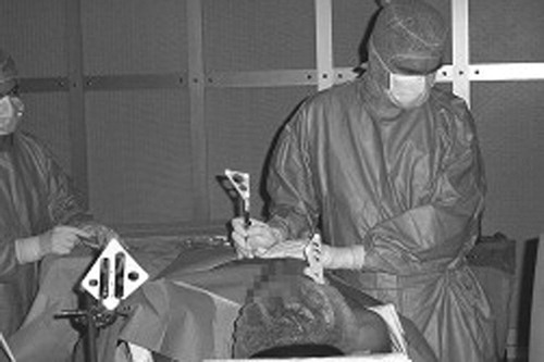 Figure 9. During the puncture, the surgeon looks at the computer screen.