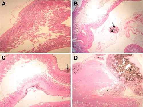 Figure 7 Histopathological effects of GONs on the intestine of rats after 21 days. Representative photomicrograph of (A) Control group (H&E, ×100), (B) Rats receiving 50 mg/kg of GONs (H&E, ×100); (C) rats receiving 150 mg/kg of GONs (H&E, ×100); and (D) Rats receiving 500 mg/kg of GONs show a high accumulation of GONs in the intestinal tissue (H&E, ×40).Notes: Black arrows indicate GONs accumulation; small black arrows indicate accumulation of GONs in the adventitia layer.Abbreviations: GONs, graphene oxide nanoplatelets; H&E, hematoxylin and eosin.
