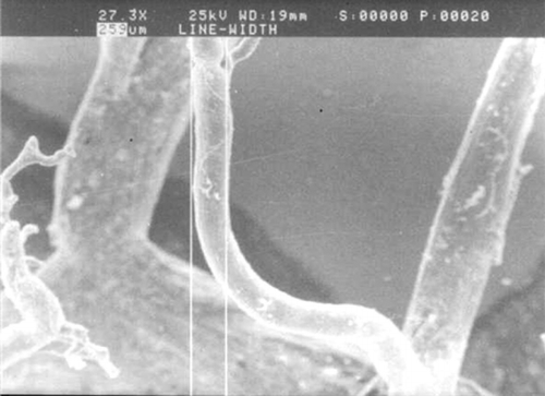 Figure 1 The morphology of lingual artery branches under a scanning electronic microscope (SEM).