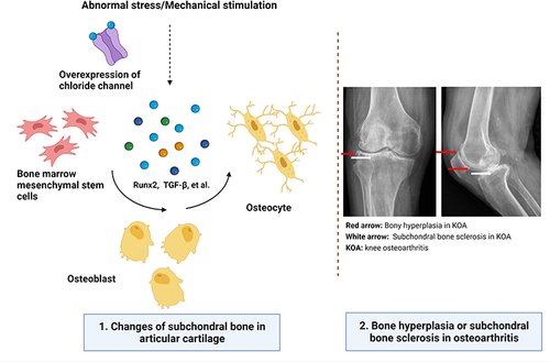 Figure 3 Mechanical interaction causes osteoarthritis. Abnormal stress and long-term mechanical stimulation upregulate the expression level of chloride channels, which induce the overexpression of osteogenic factors (Runx2, TGF-β, etc). These biomarkers stimulate the differentiation from bone marrow mesenchymal cells (BMSCs) to osteoblasts, and finally differentiate to osteocyte. (1. Changes of subchondral bone in articular cartilage) Therefore, the mechanism explains bone hyperplasia or subchondral bone sclerosis in OA. (2. Bone hyperplasia or subchondral bone sclerosis in osteoarthritis). Created with BioRender.com.