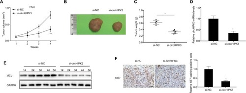 Figure 4 CircHIPK3 silencing suppressed PCa growth in vivo.Notes: (A) Tumor volumes were monitored every 1 week (Student’s t-test). (B) Representative tumors from two groups of nude mice after injection of si-circHIPK3 PC3 cells or controls cells. (C) Tumor weights were measured (Student’s t-test). (D) Relative circHIPK3 expression was detected in two groups of tumors by qRT-PCR (Student’s t-test). (E) Relative MCL1 protein expression was detected in two cell groups by WB. (F) Ki67 expression and relative positive cell numbers were determined by immunohistochemistry in each group (Student’s t-test). Scale bars: 20 µm. Quantified values were mean ± SD of at least three independent experiments. *P<0.05, **P<0.01.Abbreviations: NC, negative control; WB, Western blot; qRT-PCR, quantitative real-time reverse transcription PCR.