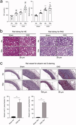 Figure 2. 5/6 nephrectomy with high-phosphorus diet induces chronic kidney disease (CKD)-associated vascular calcification in rats. a) Serum biochemical measurements. Serum creatinine (SCr) and blood urea nitrogen (BUN) in the CKD and sham groups at 4 and 16 weeks. #p < 0.05, ## p < 0.01, 4 vs. 16 weeks within the same treatment; + p < 0.05, ++ p < 0.01, CKD vs. Sham at the same time point; n ≥ 6 in each group. b) Hematoxylin-eosin (HE) and periodic acid-Schiff (PAS) staining of rat kidneys from the CKD and sham groups at 4 and 16 weeks. c) Alizarin red S staining of rat aortas and quantification in the CKD and sham groups at 4 and 16 weeks. Arrows indicate the arterial medial calcification areas. The microscopic magnification of rat kidney is 400×, and those of the rat vessel are 200× and 800×. Scale bars = 20 and 100 μm.