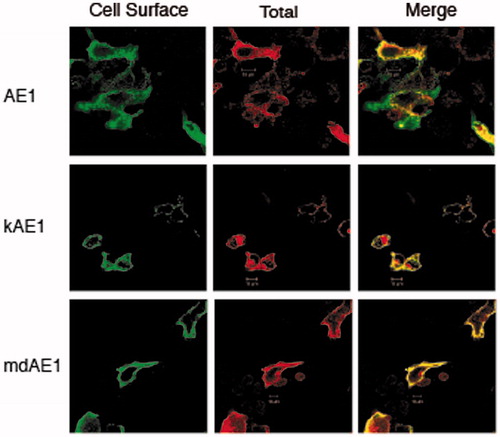 Figure 8. Immunolocalization of AE1, kAE1 and mdAE1 in transfected HEK cells was performed described in Figure 3. Cell surface expression of AE1, kAE1 and mdAE1 in intact cells was visualized as green, total expression in permeabilized cells was visualized as red and the overlap in yellow. All proteins could be detected at the cell surface (yellow) as well as intracellularly (red). (In the black and white version of this figure, the yellow colour is seen as bright.)