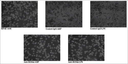 Figure 5. Morphology of DCs treated with RGMa-neutralizing antibodies under light microscope. Morphology was determined after 10 μg/ml antibody treatment for 48 h. Magnification ×400