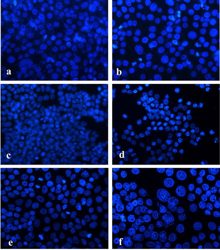 Figure 3. Fluorescence microscopy of DAPI stained human tumour cells after 24-h treatment with diclofenac. HeLa cells (a, b): control (a) and treated (b) with 300 µg/mL diclofenac; HT-29 cells (c, d): control (c) and treated (d) with 100 µg/mL diclofenac; MCF-7 cells (e, f): control (e) and treated (f) with 300 µg/mL diclofenac. 40Х magnification.