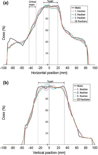 Figure 8. Horizontal profile (a) and vertical profile (b) illustrated for the same dose distributions as in Figure 7, in addition to a dose distribution calculated for 25 fractions. The profile lines are shown as with dashed lines in Figure 7 and are both centered on the iso-centre. Both the position of the target and the critical organ is illustrated for the investigated profile lines.